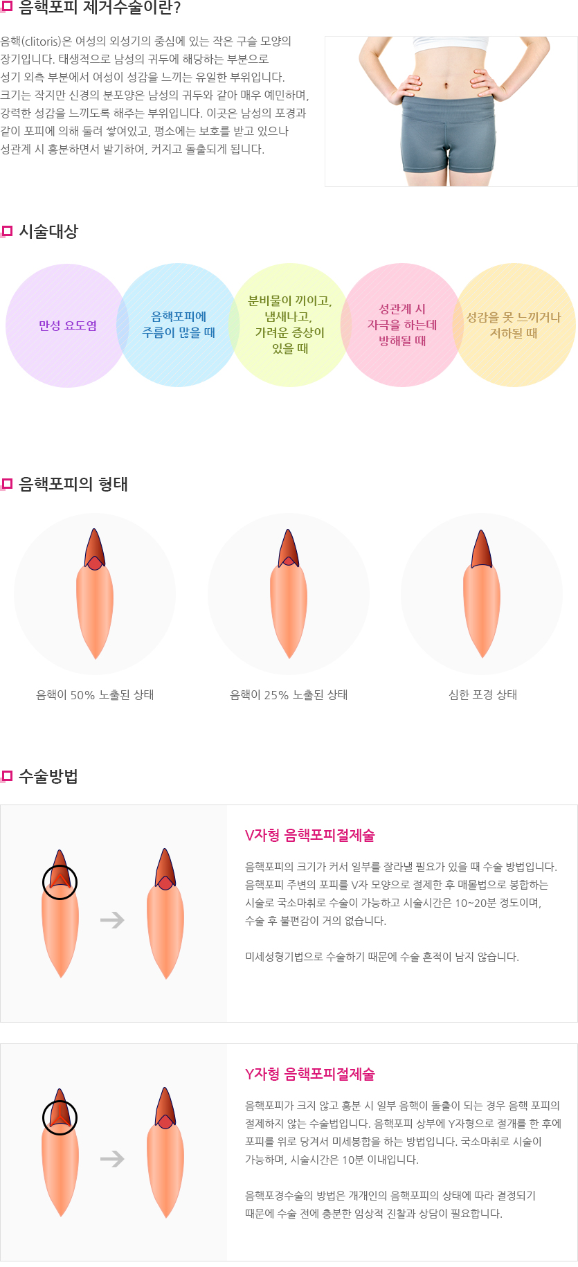 음핵포피 제거술